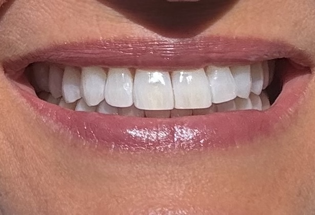 Cosmetic