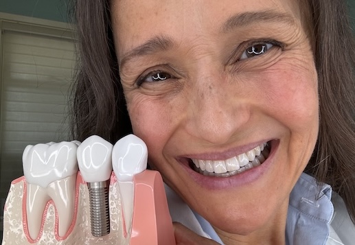 Dental Implants