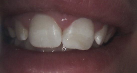 smile gallery image