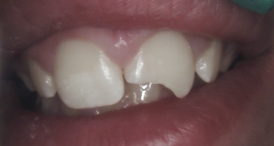 smile gallery image