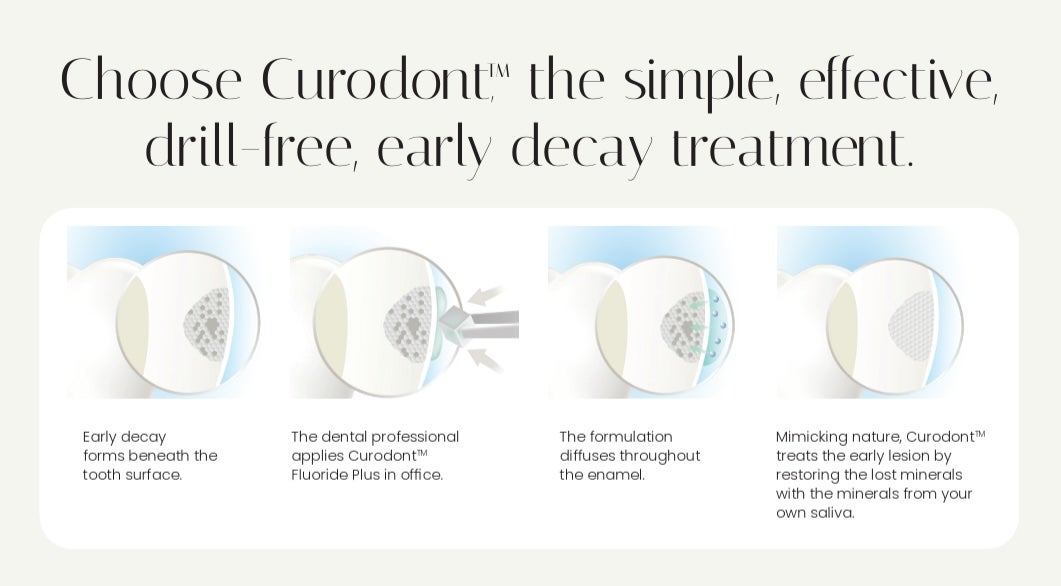 Early Cavity Prevention