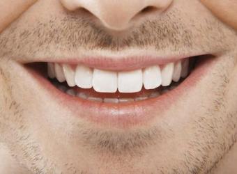 Dental Bonding: The Quick-and-Easy Way to Improve Your Smile