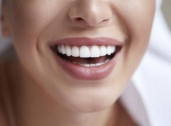 Changing the Look of Your Smile With Veneers